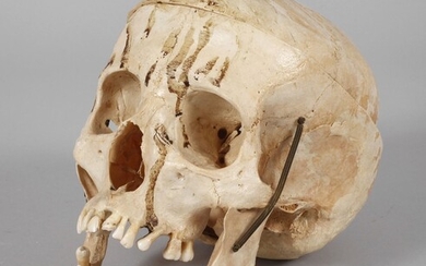 Modèle médical de démonstrationâge indéterminé, crâne humain avec calotte crânienne ouvrable et articulation de la...