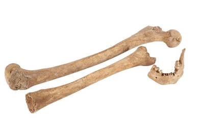 ARCHEOLOGY /OSTEOLOGY: ROMAN HUMAN BONES
