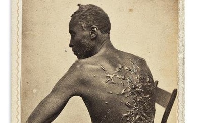 (SLAVERY & ABOLITION.) McPherson & Oliver; photographers. [The Scourged Back.]