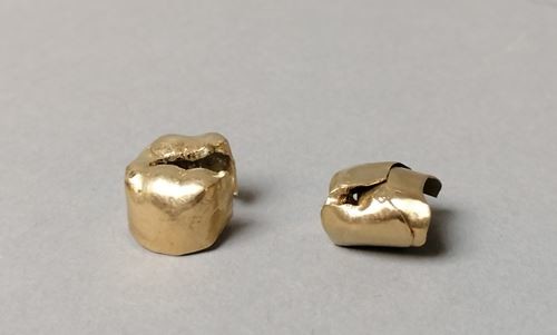 Gold tooth debris. Weight: 4.5g.