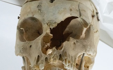 Dis-articulated Human Skull